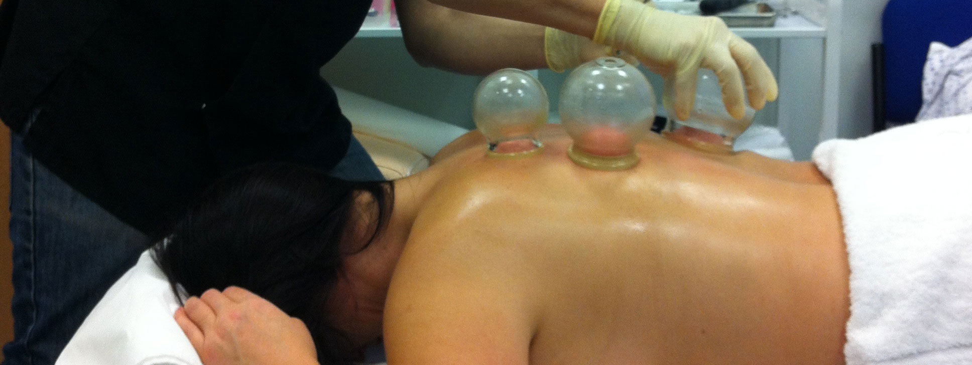 Cupping therapy