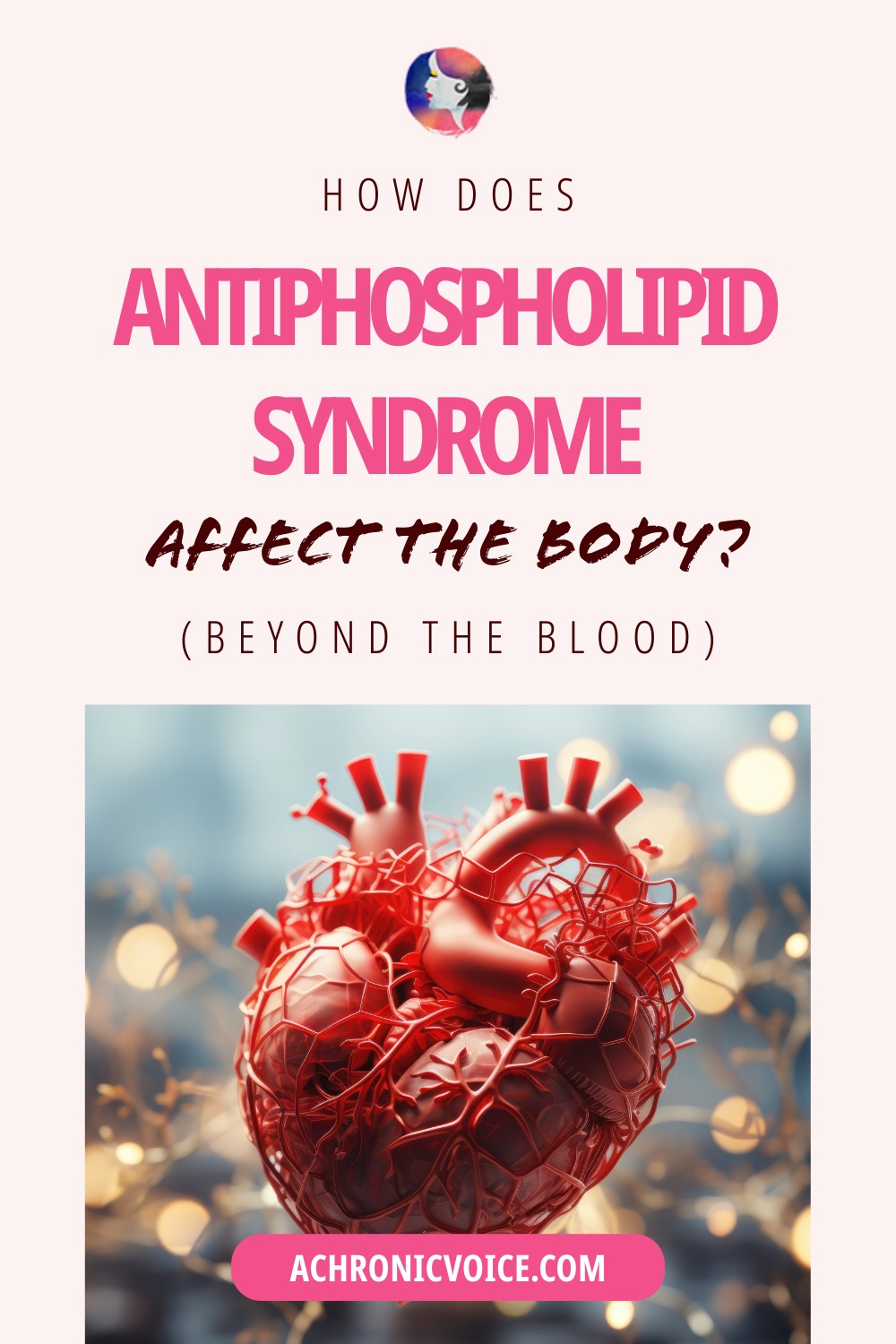 How Does Antiphospholipid Syndrome Affect The Body? (Beyond the Blood to Major Organs)