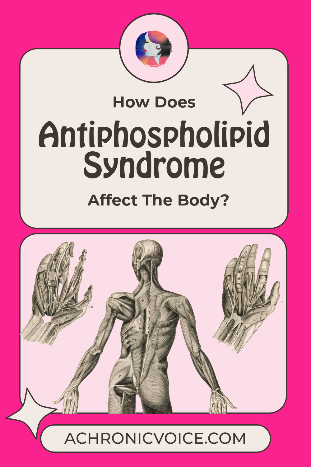 How Does Antiphospholipid Syndrome Affect The Body? (Beyond the Blood to Major Organs)