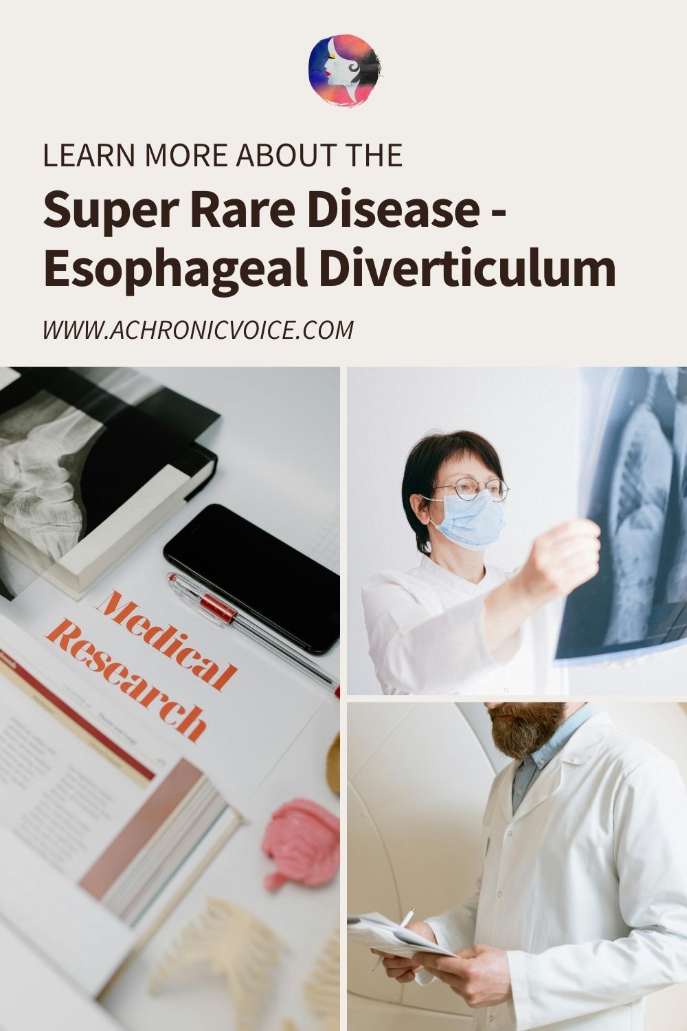 Learn More About the Super Rare Disease — Esophageal Diverticulum