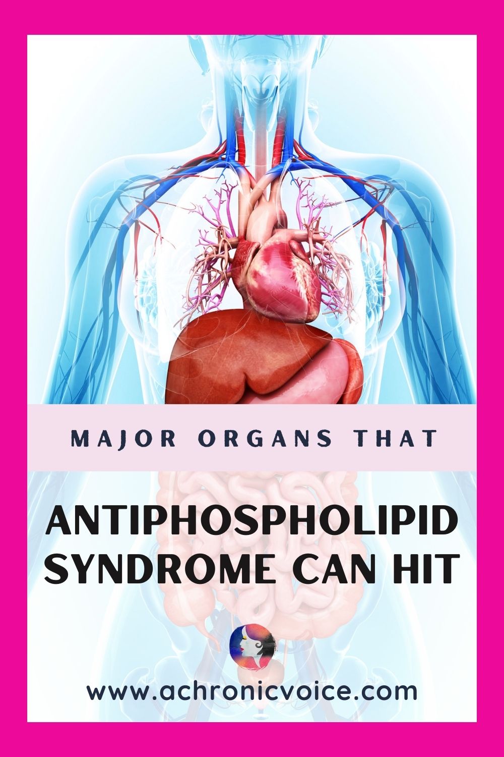 How Does Antiphospholipid Syndrome Affect The Body? (Beyond the Blood to Major Organs)