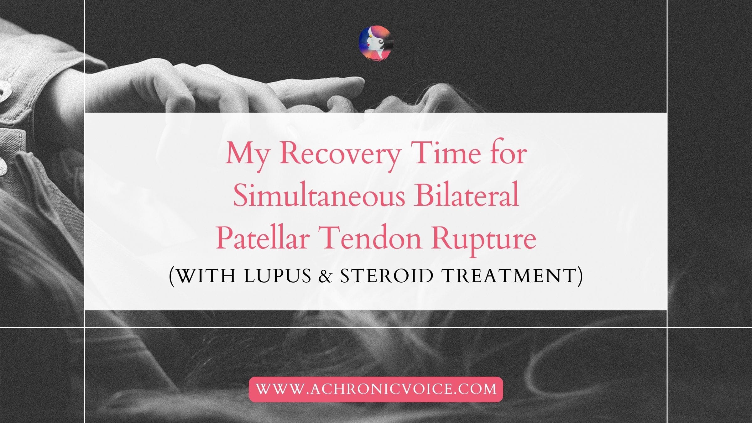 My Recovery Time for Simultaneous Bilateral Patellar Tendon Rupture (With Lupus and Steroid Treatment)